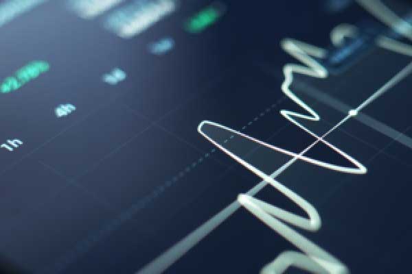 随着利率市场波动性下降 华尔街对冲策略适得其反